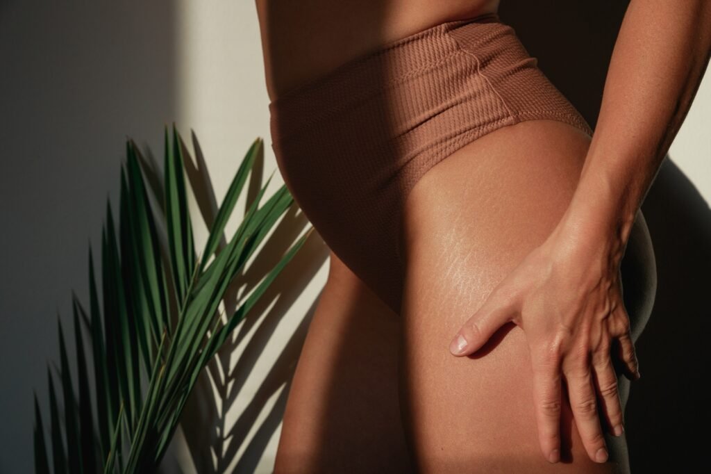 Woman with natural body contours and stretch marks on her thighs. Concept of body positivity